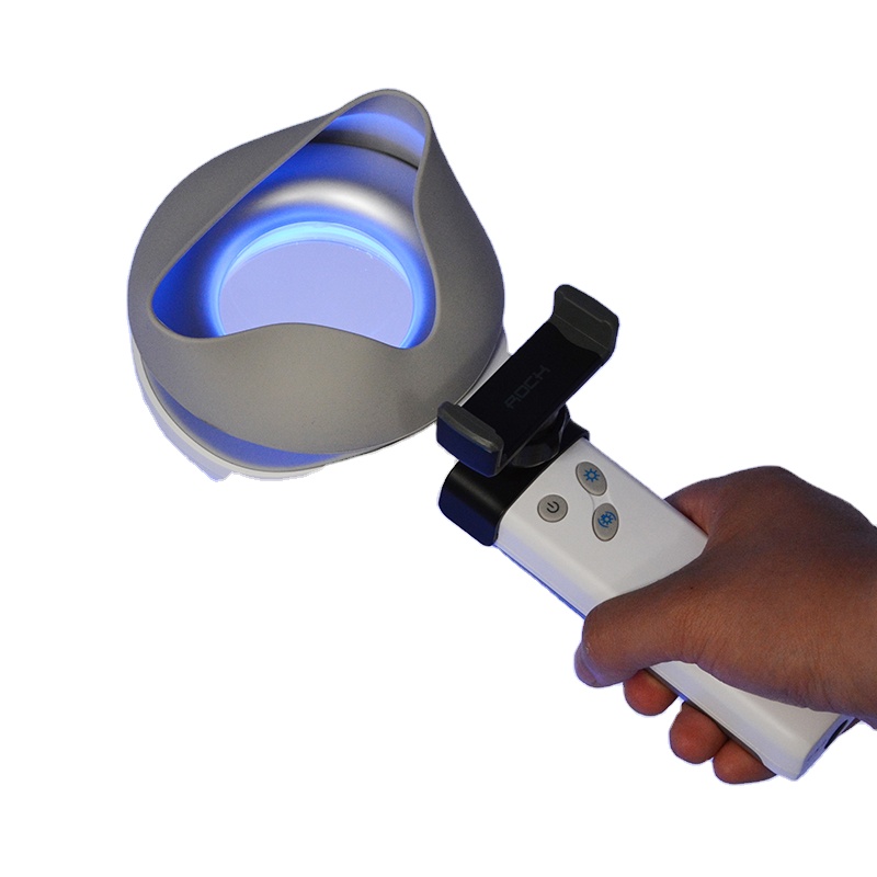 Huidstoornis  Depigmentatie en - Led Medical Headlight recensie en prijs