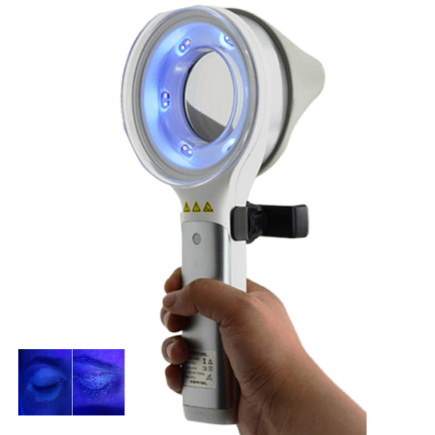 Huidstoornis  Depigmentatie en - Led Medical Headlight recensie en prijs